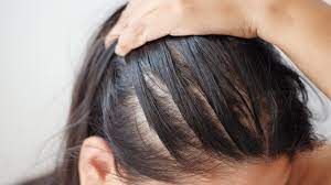 Hair loss got you worried? Addressing hair loss with effective treatments and products.