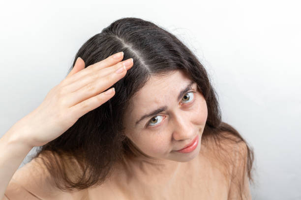 Dealing with Seasonal Hair Loss: Tips and Tricks