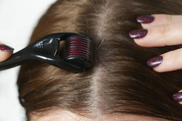Can Massaging Your Scalp Be the Secret to Luscious Locks? Unveiling the Benefits for Hair Growth!